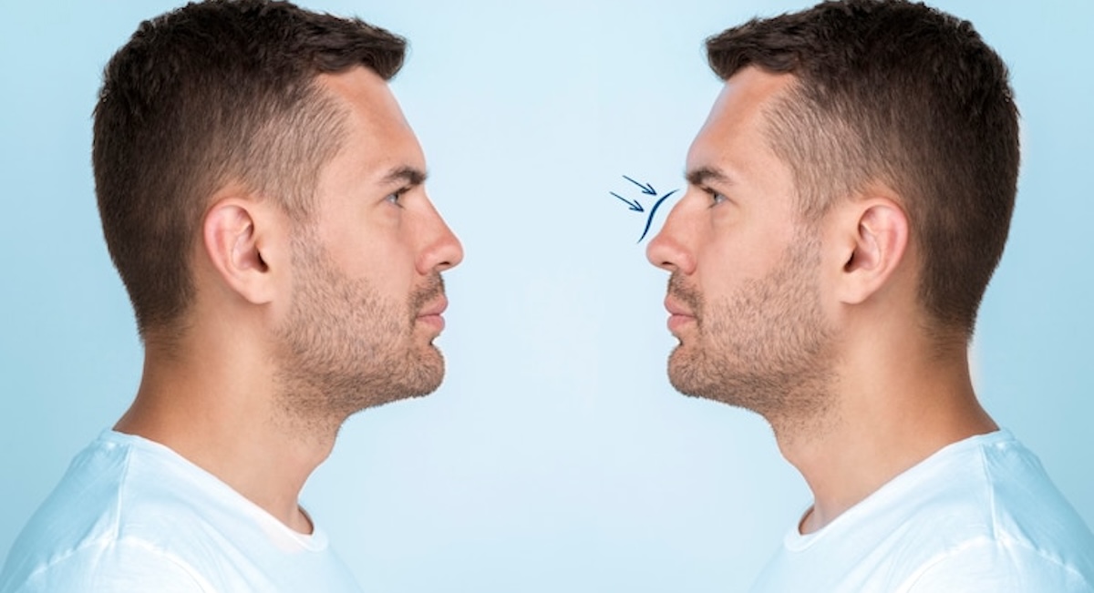 Before and After Plastic Surgery Results