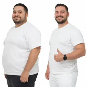 Gastric Sleeve Procedure